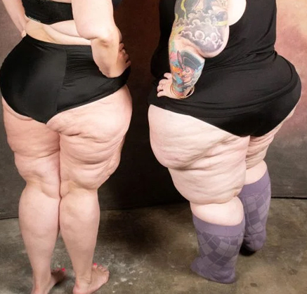 shape
